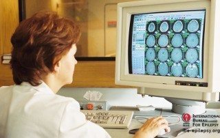 What Is Epilepsy_ - ibe-epilepsy