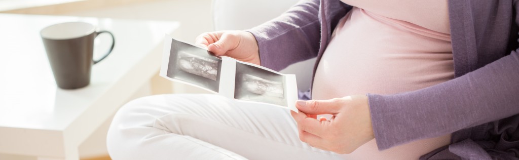 Woman holding an ultrasound image of her baby
